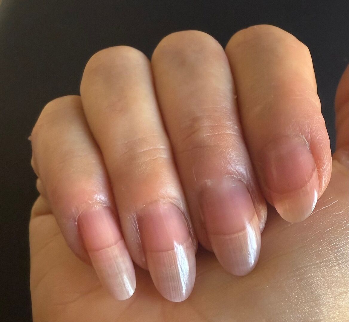 Ongles durs