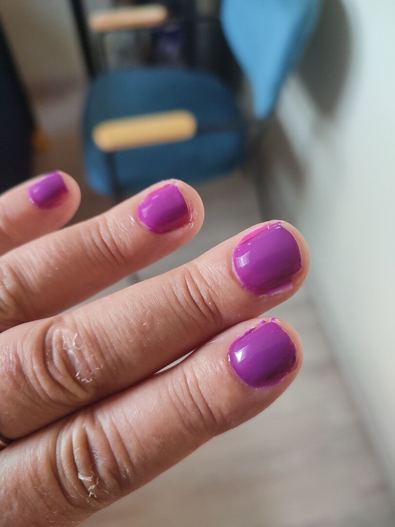 Ongles fermes