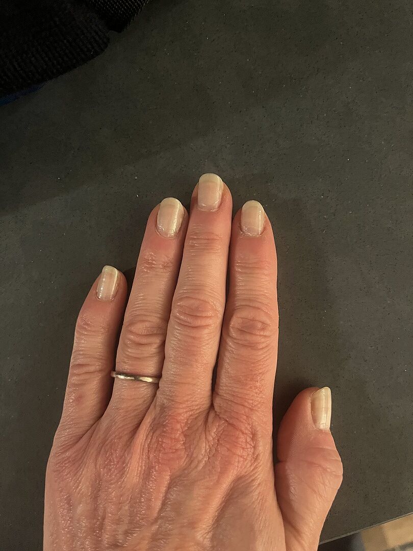Ongles souples