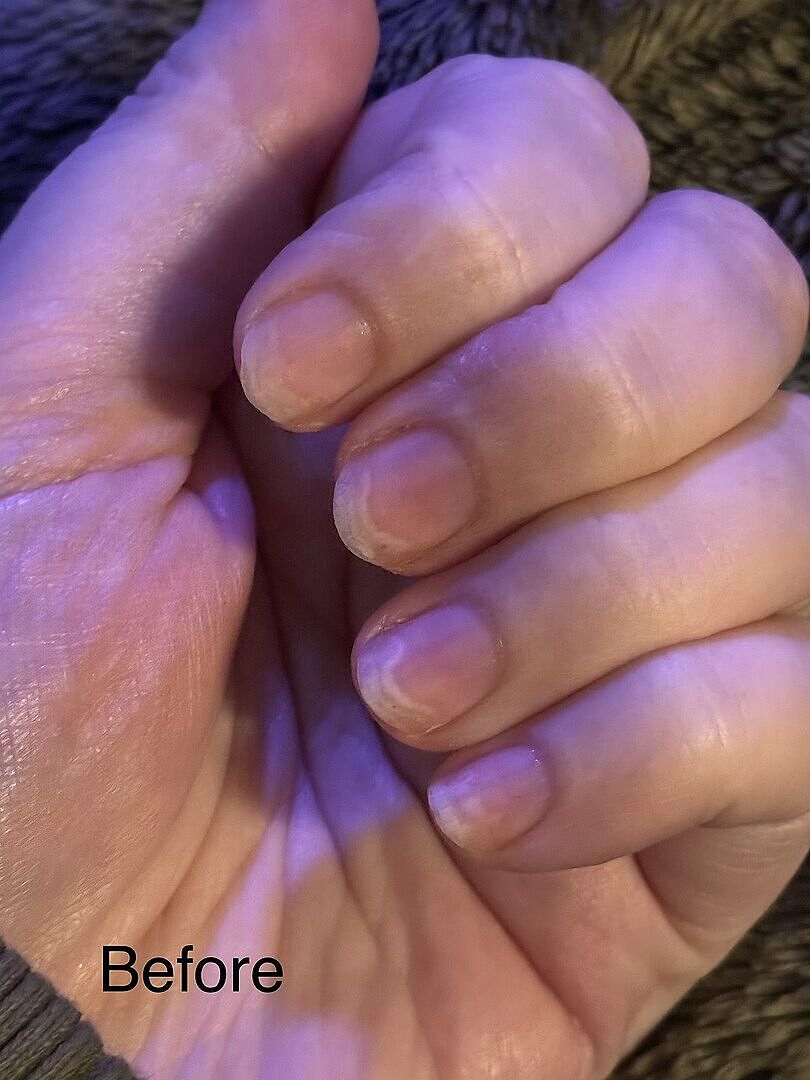 Ongles fermes