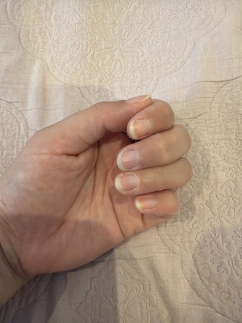 Ongles durs