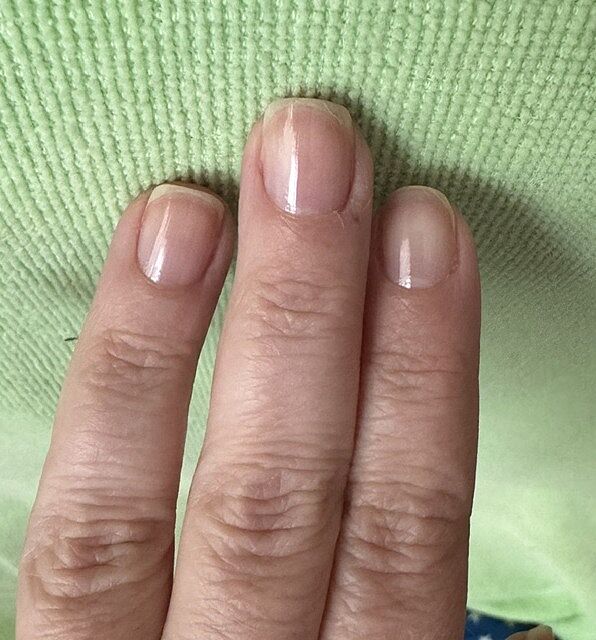 Ongle lisse