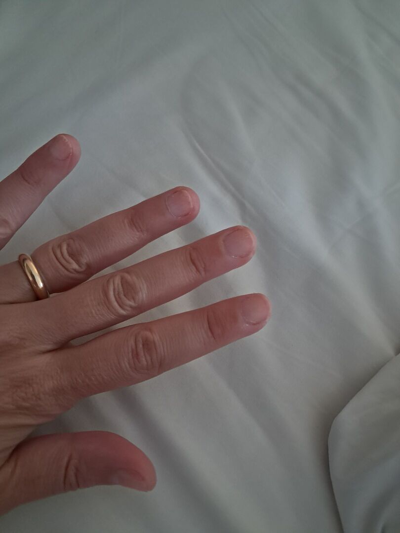 Ongles solides