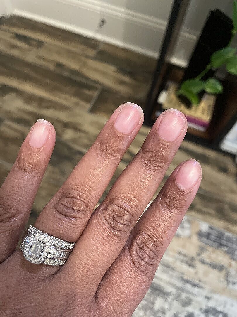 Ongles durs