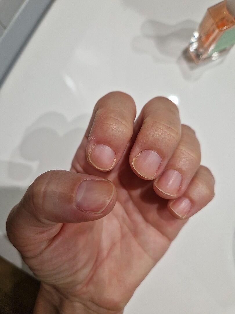 Surface lisse