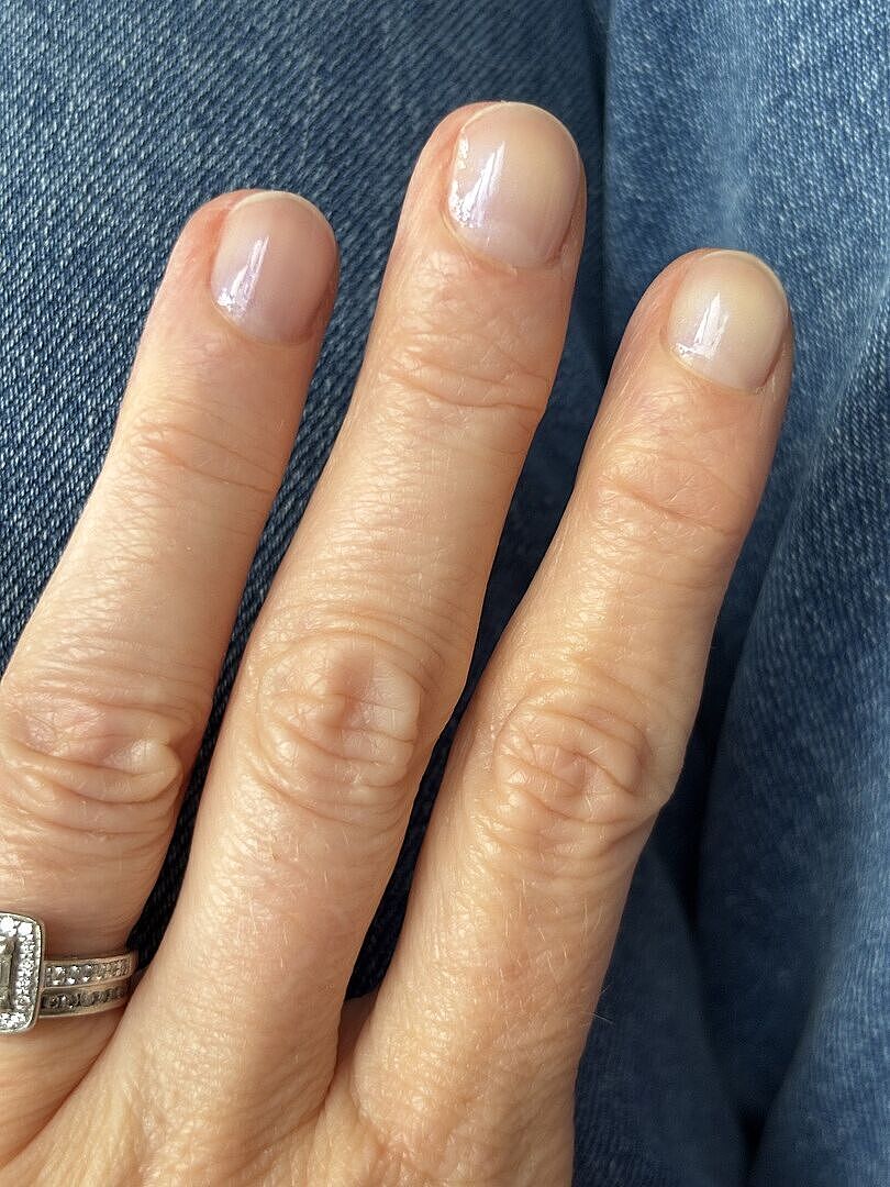 Ongles durs