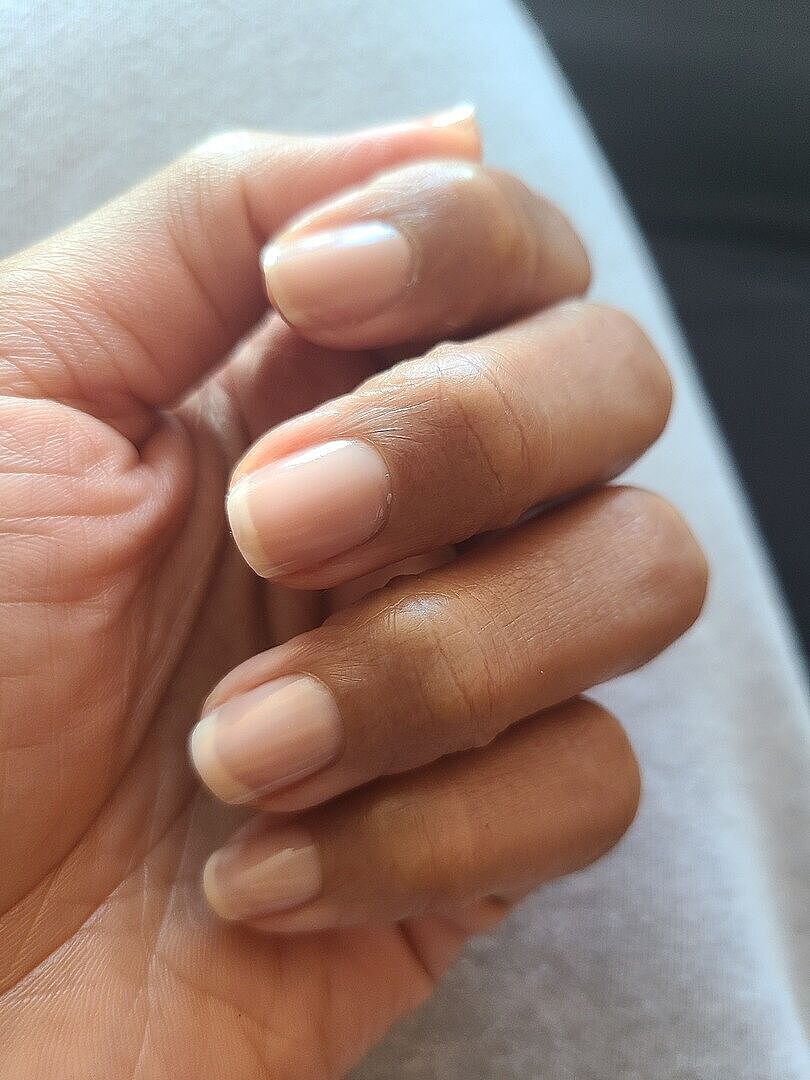 Ongles durs